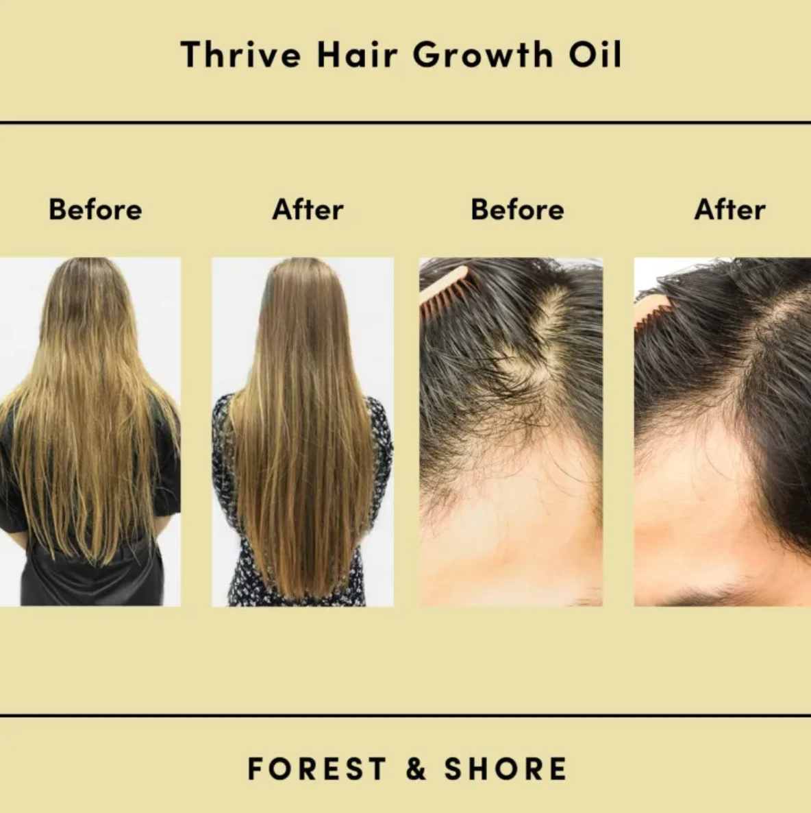 BabboSow Rosemary Hair Growth Oil