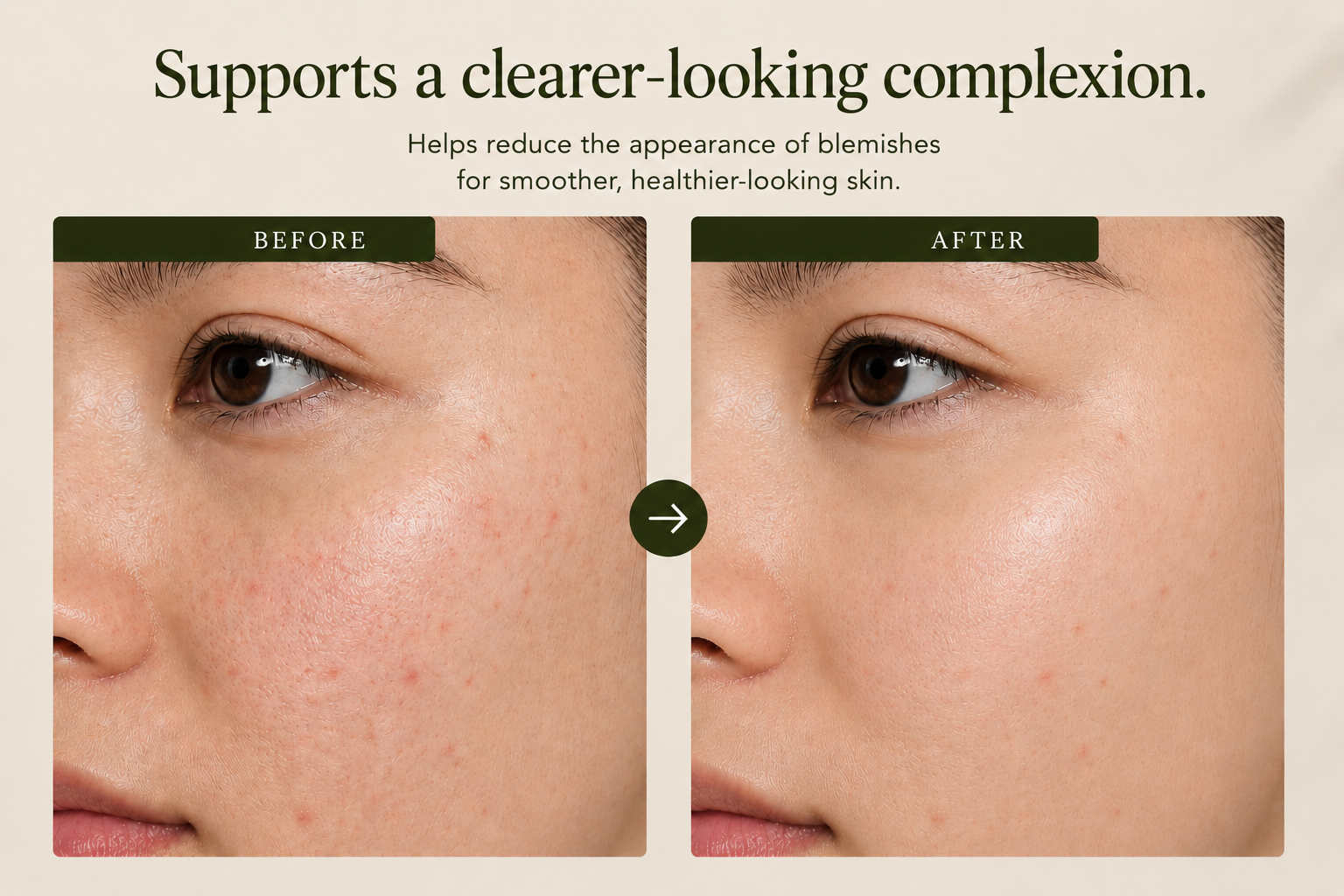 Eminence Organic Skin Care Clear Skin Willow Bark Booster-Serum