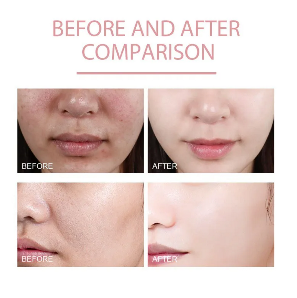 Hoygi Nicotinamide Hydrating & Brightening Serum